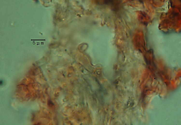Lavoro - Crosta foto 0601 (Phlebiella fibrillosa)